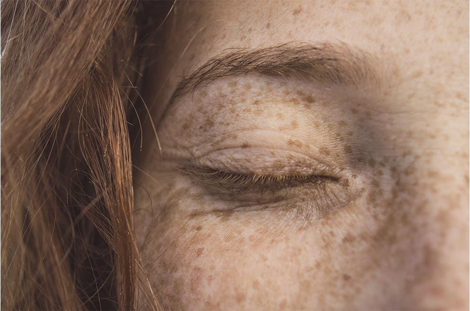 Nahaufnahme des Gesichts einer Frau mit Sommersprossen